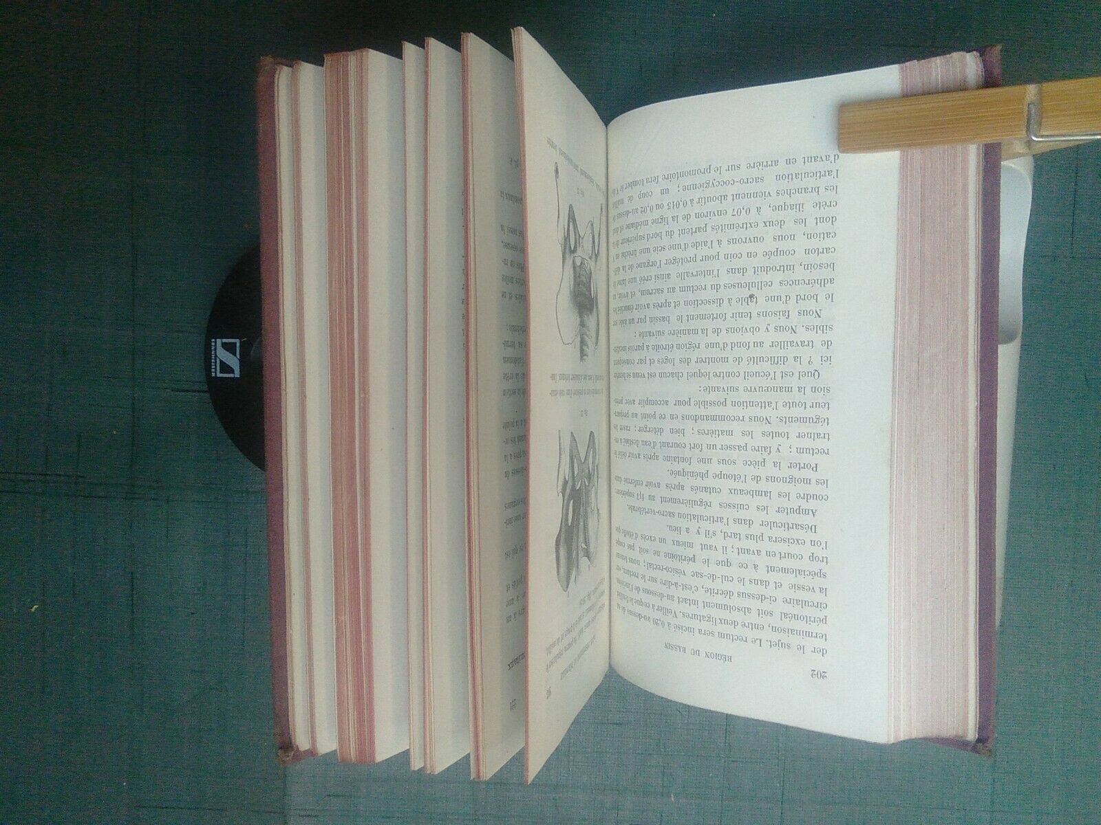 Auffret Charles Manuel De Dissection Des Regions Et Des Nerfs Doin 18 Marche Dauphine